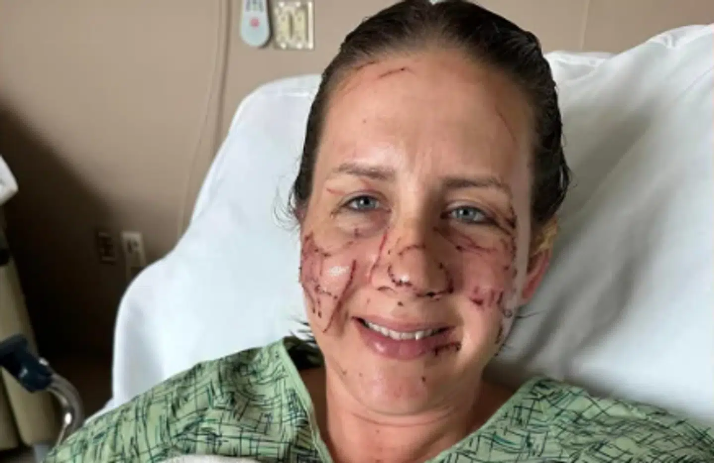 Her ses Jen Royce ligge i en seng på et hospital i Montana, efter hun og to andre kvinder var blevet angrebet af en odder.