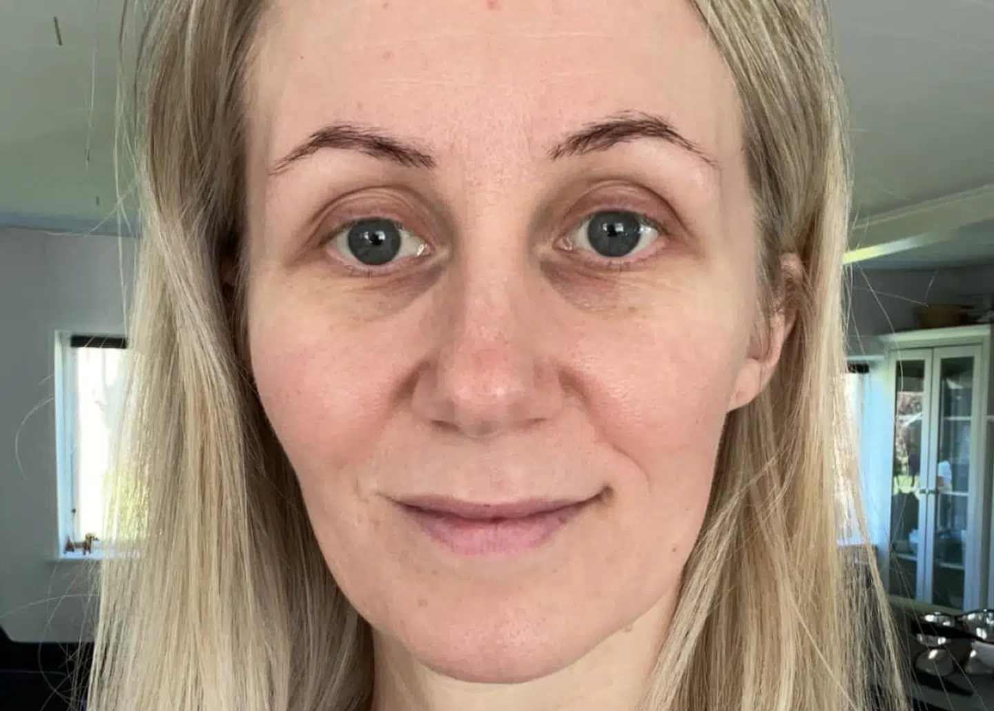 Når Trine Uldum Sejrup overanstrenger sin krop, får hun anfald med smerter, en overvældende udmattelse og lyd- og lysforstyrrelser.