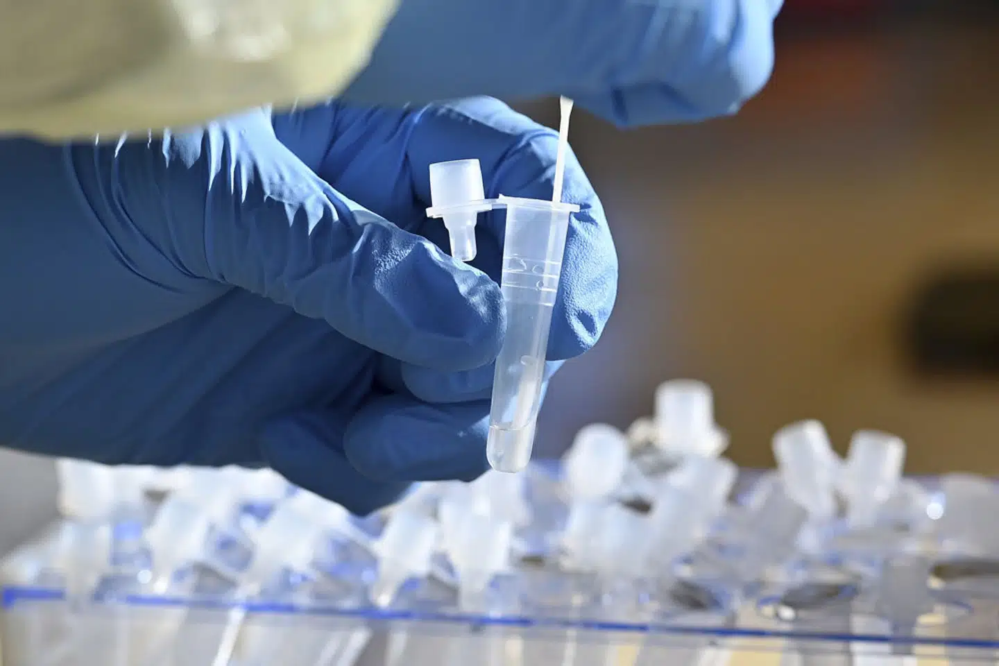 Der er stor international opmærksomhed omkring fundene af den nye variant, skriver SSI. (Arkivfoto). – Foto: Frank Hoermann / Sven Simon/Ritzau Scanpix