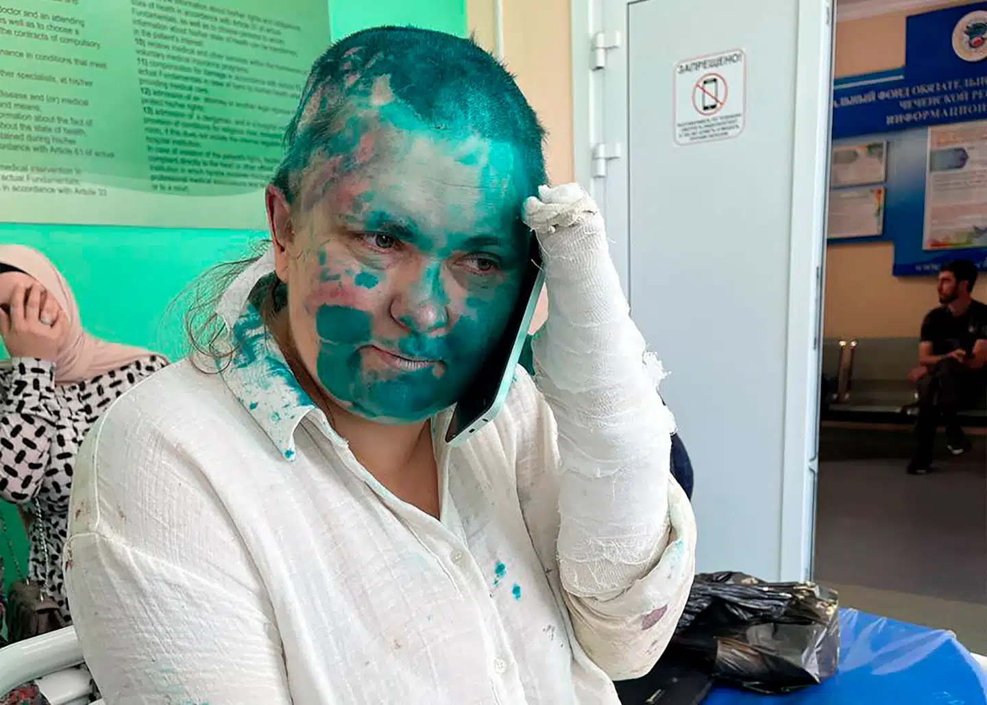 Den russiske journalist Jelena Milasjina på hospitalet efter det voldsomme overfald. Foto: Sergei Babinets, Scanpix