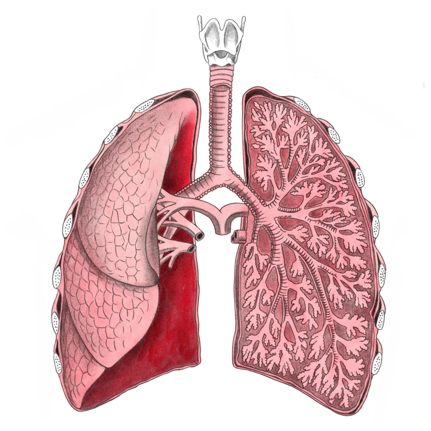 I de værste sygdomstilfælde ødelægger tuberkulose vævet i lungerne. Illustration: Sine Jensen