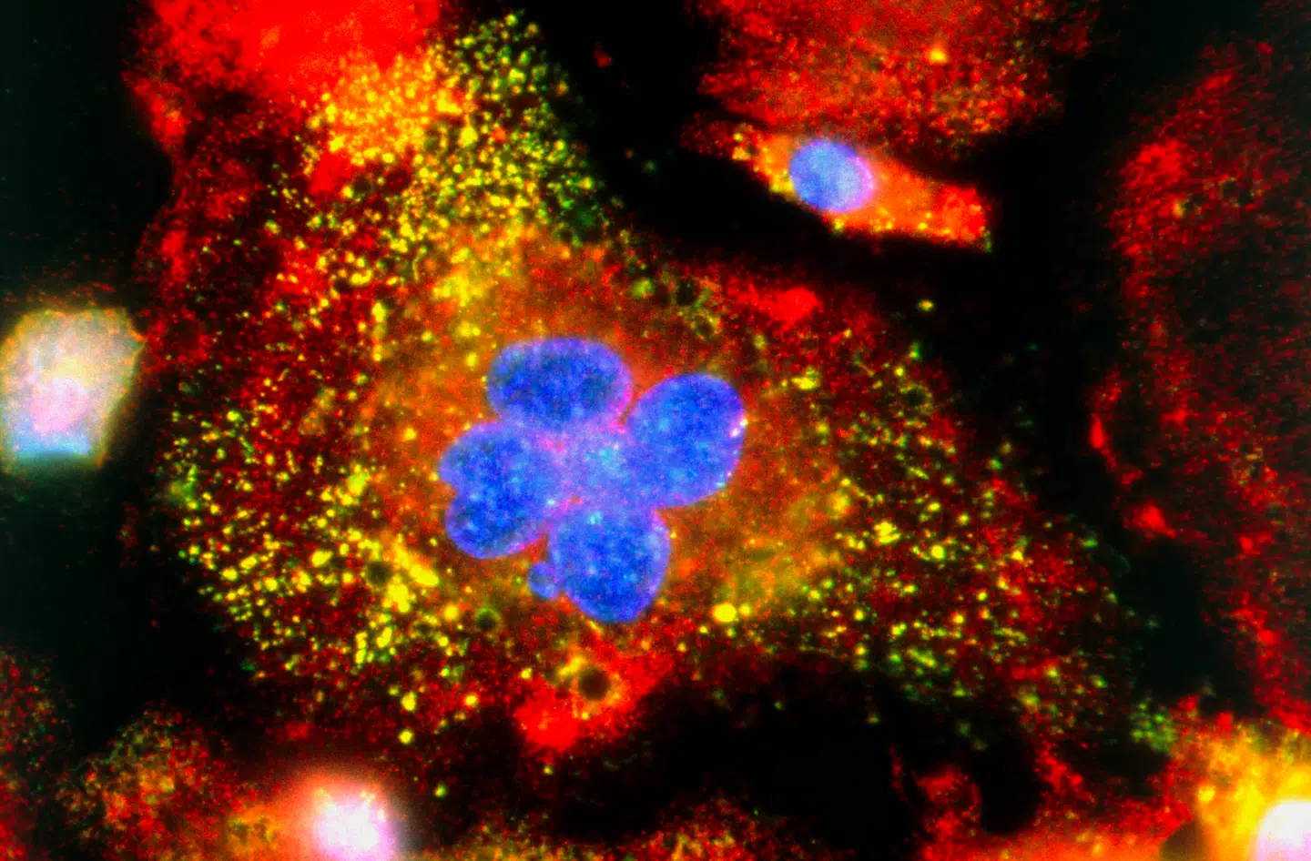 På billedet ses en makrofag (cellekerner i blå) i gang med at producere cytokiner. De gul-grønne prikker er proteinet TIA-1, som kan binde cytokiner og dermed stoppe overproduktion. Foto: Science Photo Library/Scanpix