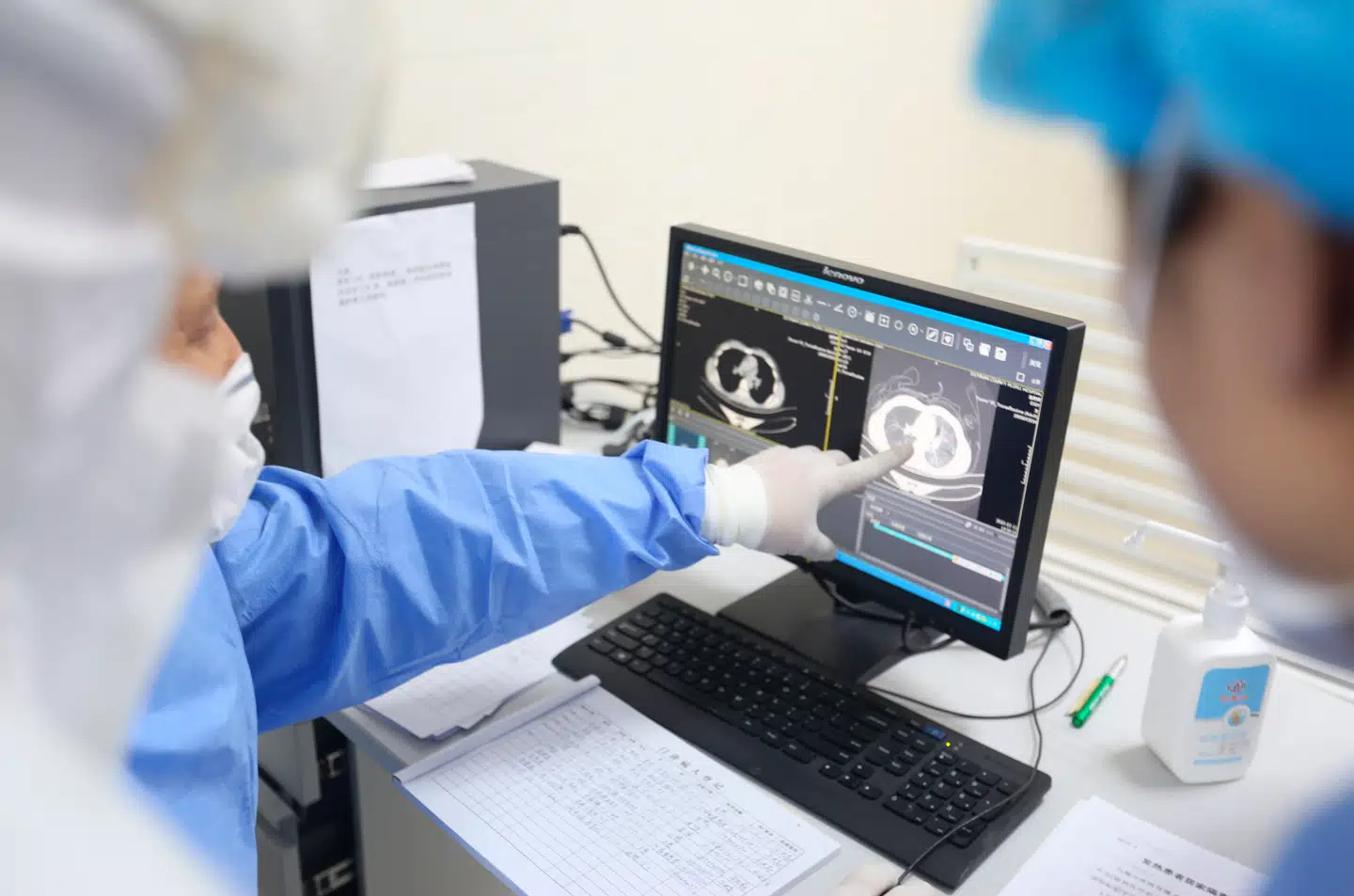 Kinesiske læger ser på CT-billeder af lungerne hos en patient, der er smittet med COVID-19 . Foto: Wang Yanbing/FEATURECHINA/Scanpix