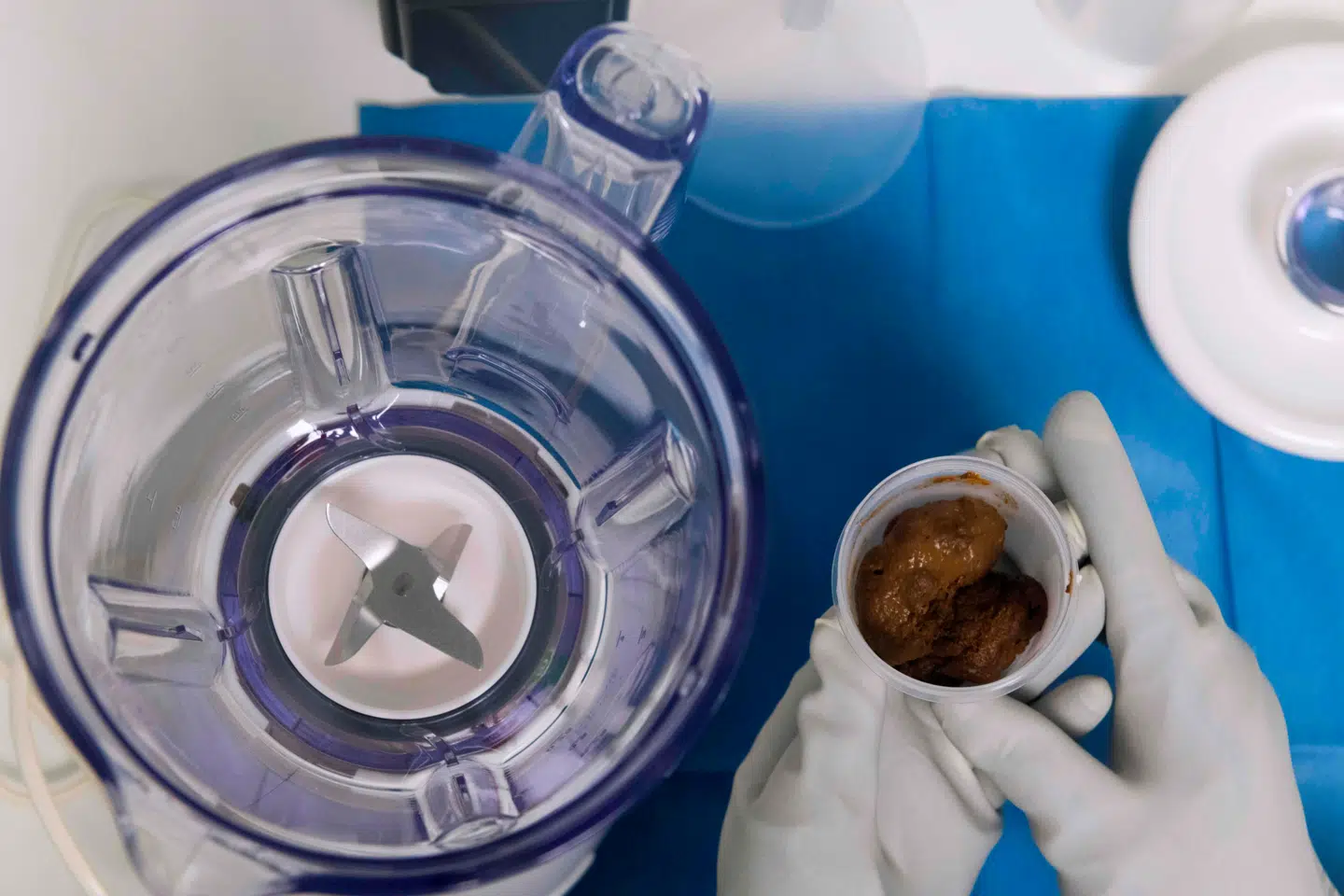 På Centre Hospitalier Universitaire forberedes afføring til at behandle patienter med alvorlige infektioner i tyktarmen. Foto: Thierry Zoccolan/AFP