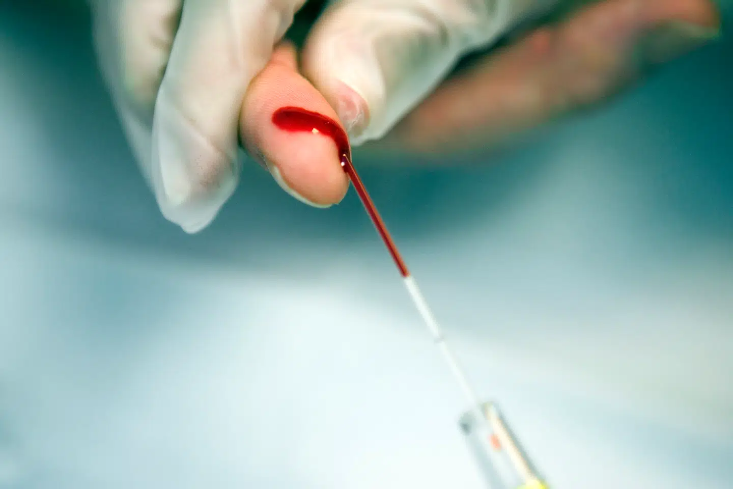 Mens det er svært at finde beviser på, at præventiv præcisionsmedicin har den ønskede effekt, har forskerne nemt ved at få øje på potentielle problemer: For eksempel overdiagnosticering. Arkivfoto: Erik Refner/Ritzau Scanpix