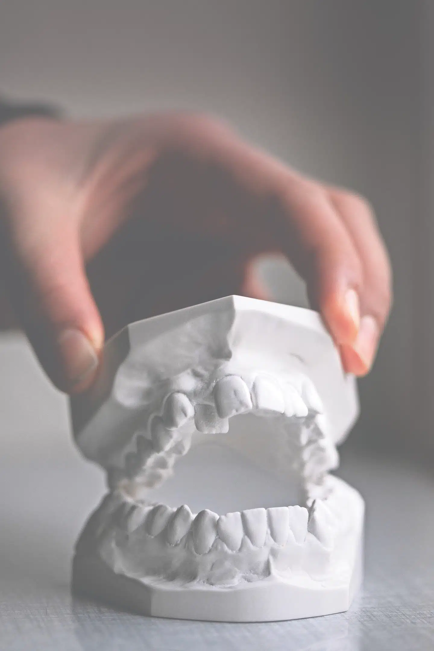 Gipsafstøbning af tænder.