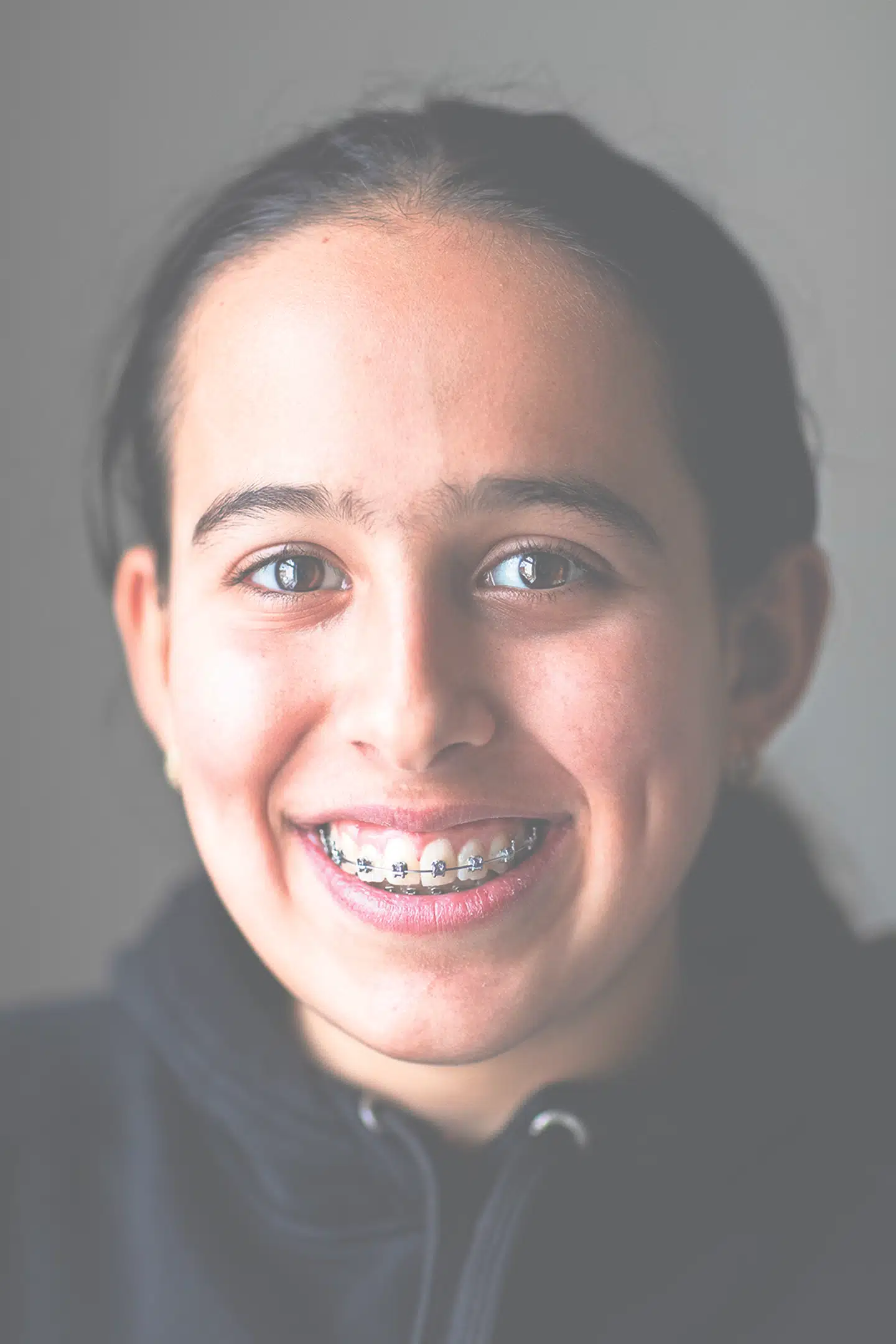 14-årige Aylin er vant til at gå til tandlæge, for togskinnerne skal strammes jævnligt.