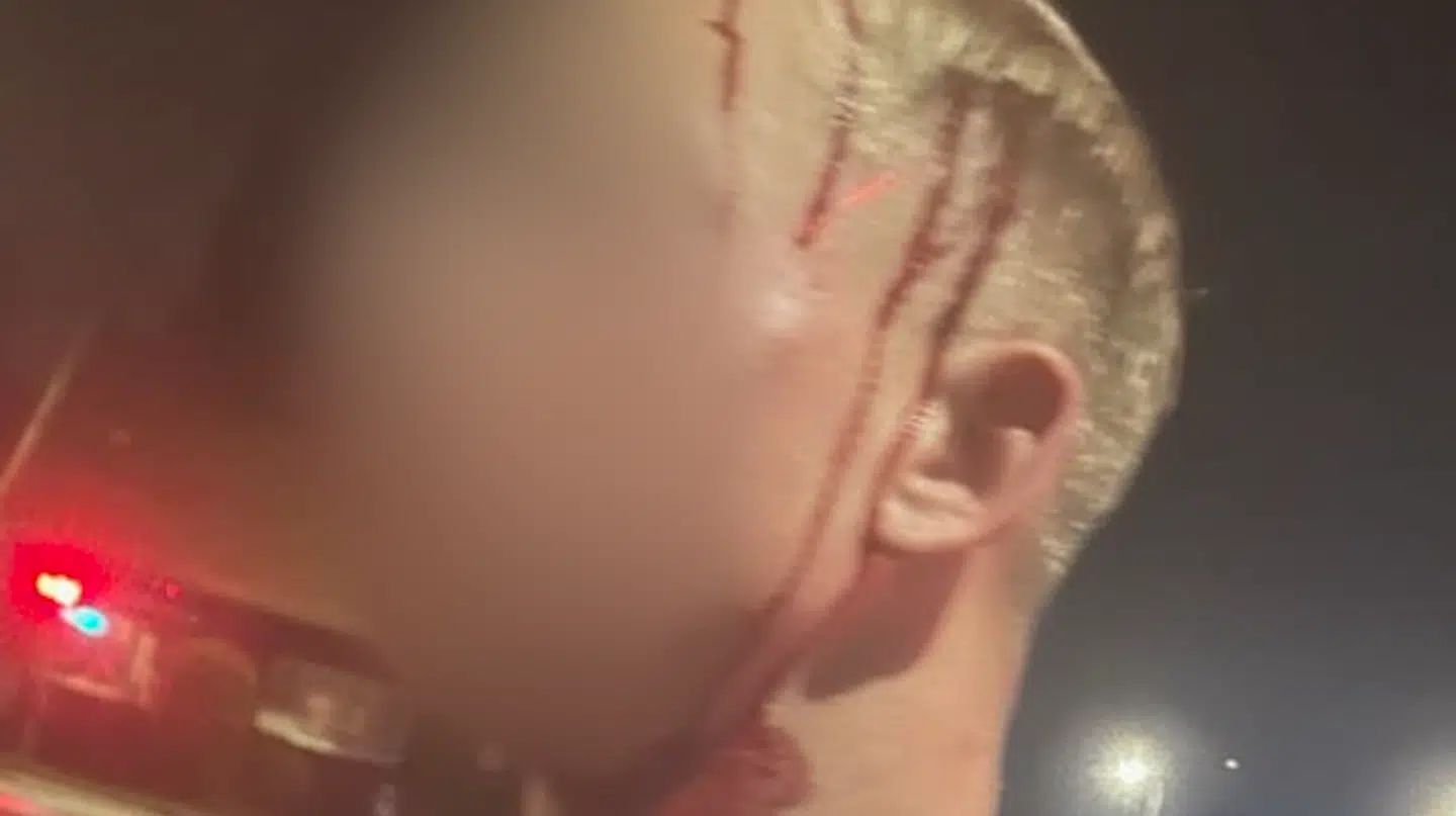 Blodet løber nedover den 19-årige mand fra en flænge i hovedbunden.