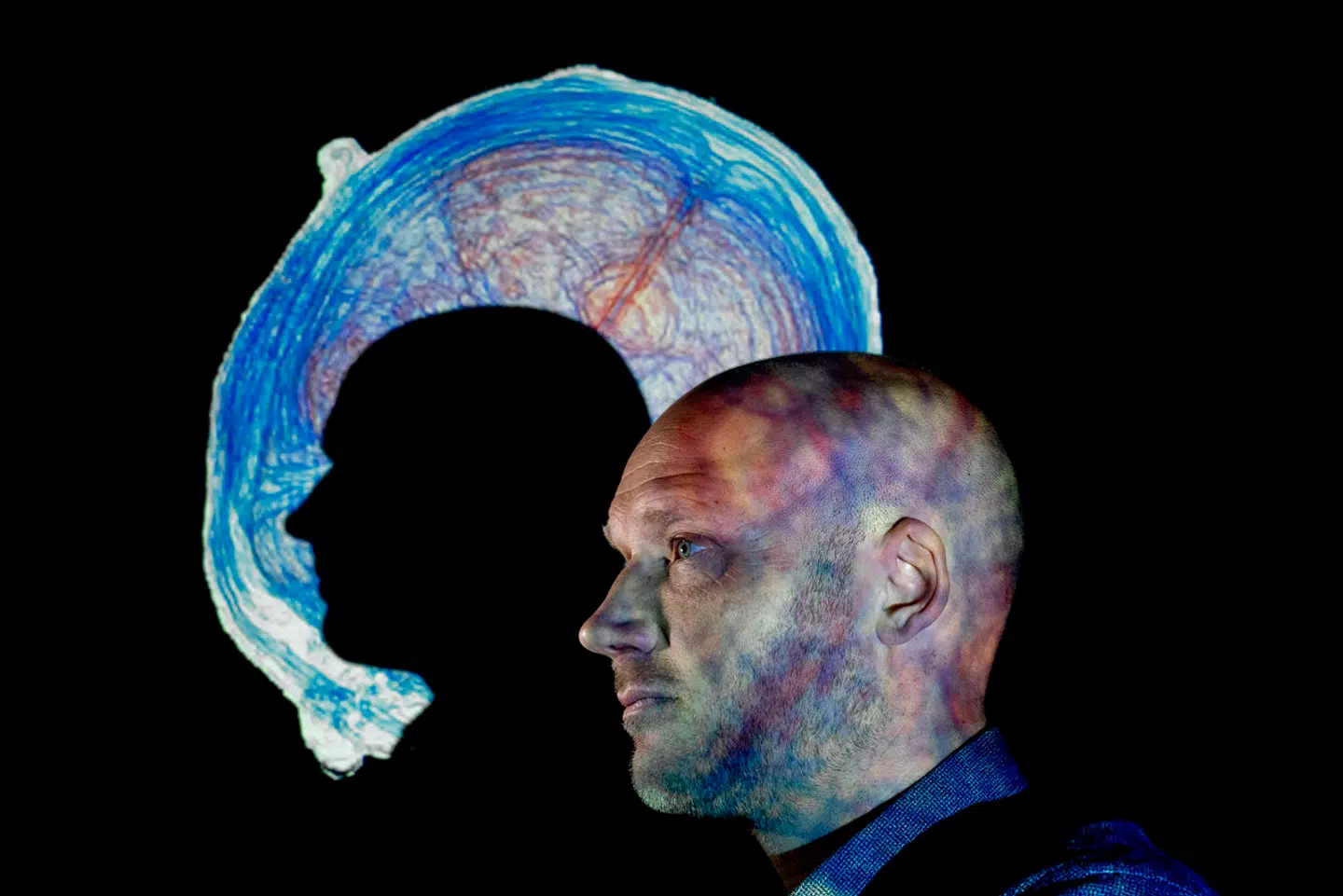 En hjernerystelse kan give alvorlige følger senere i livet, viser ny forskning. Hjernerystelsesforeningen kommer med syv anbefalinger til, hvad du kan gøre, hvis du er blandt de uheldige.