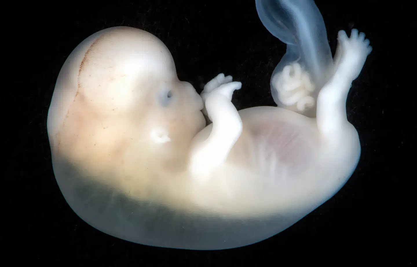 Regeringen er klar til forhandlinger om at hæve abortgrænsen, men flere borgerlige partier har stærke holdninger til den følsomme debat.