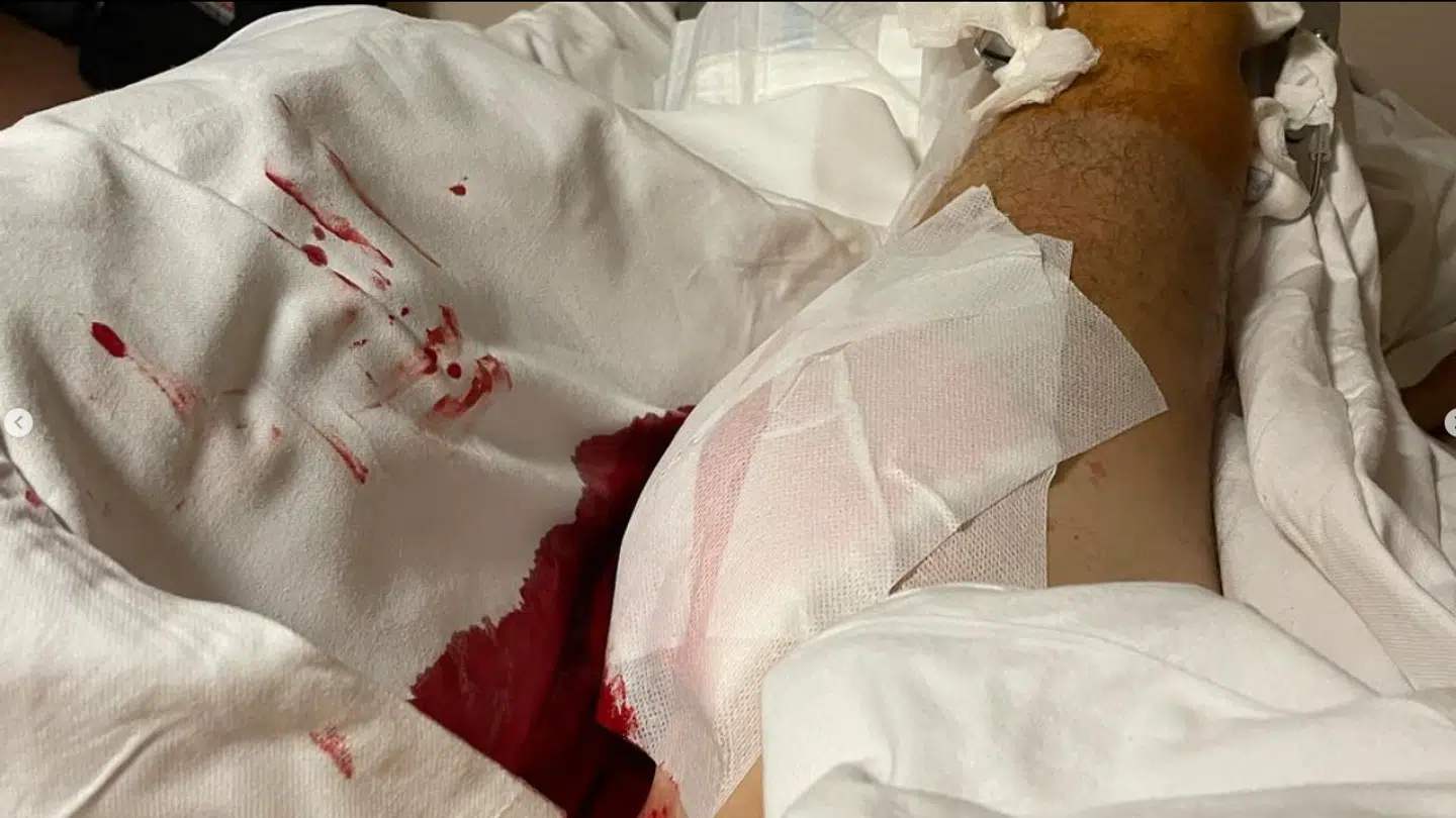 Nicki Pedersen i sin hospitalsseng.