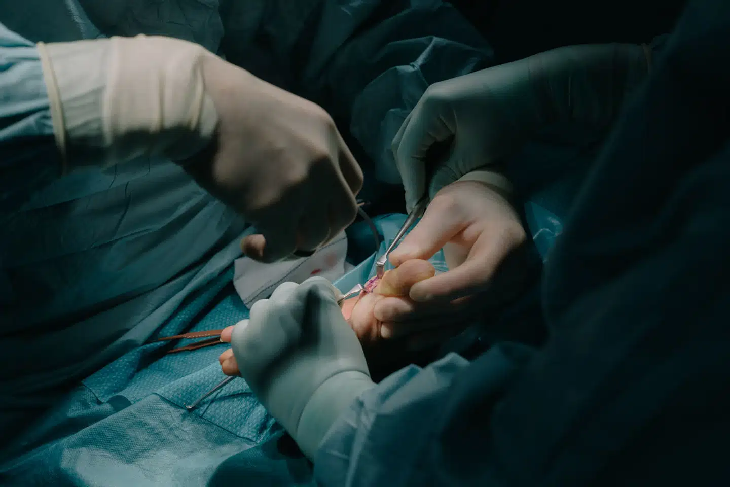 »Det er synd for det offentlige hospitalsvæsen, men det er endnu mere synd for alle de borgere, som rammes af den enorme ulighed, som privathospitalerne generer,« skriver Niels Bentzon.