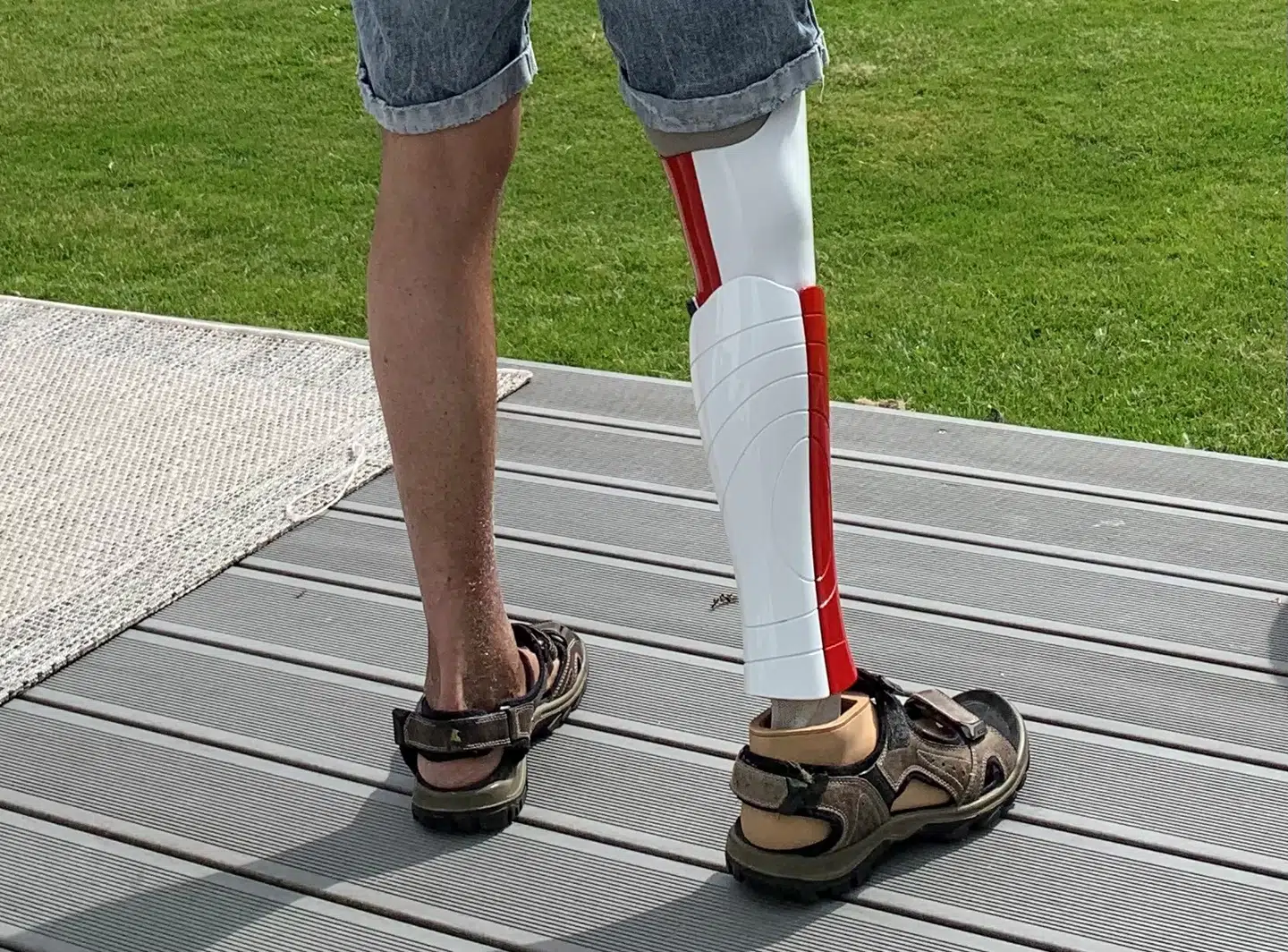 Knud Boisens benprotese.