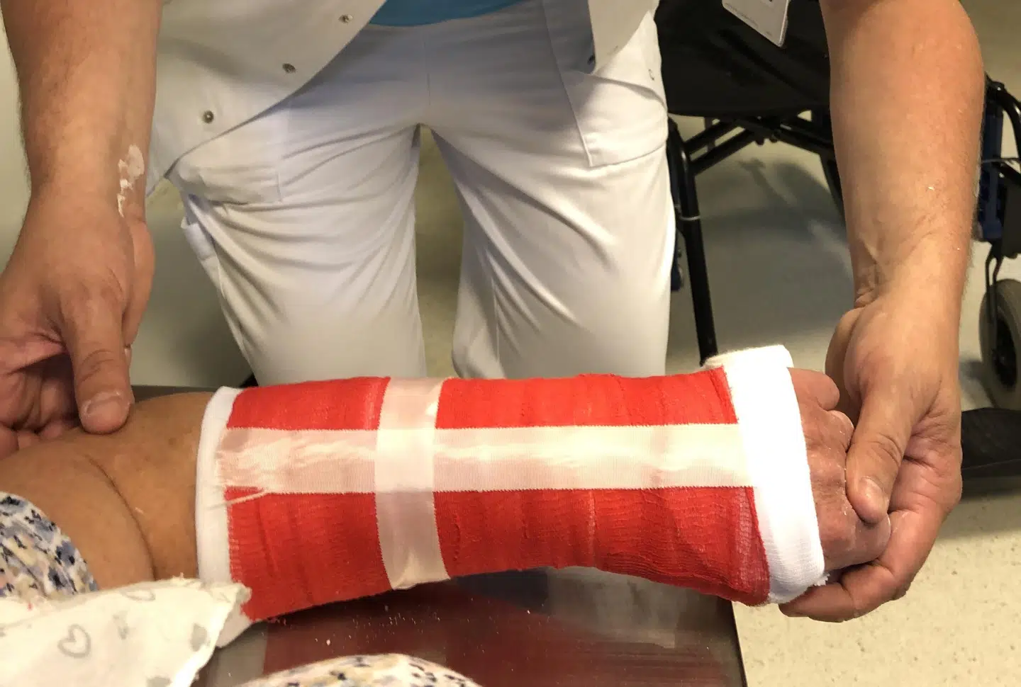 Gipsarmen er pyntet.