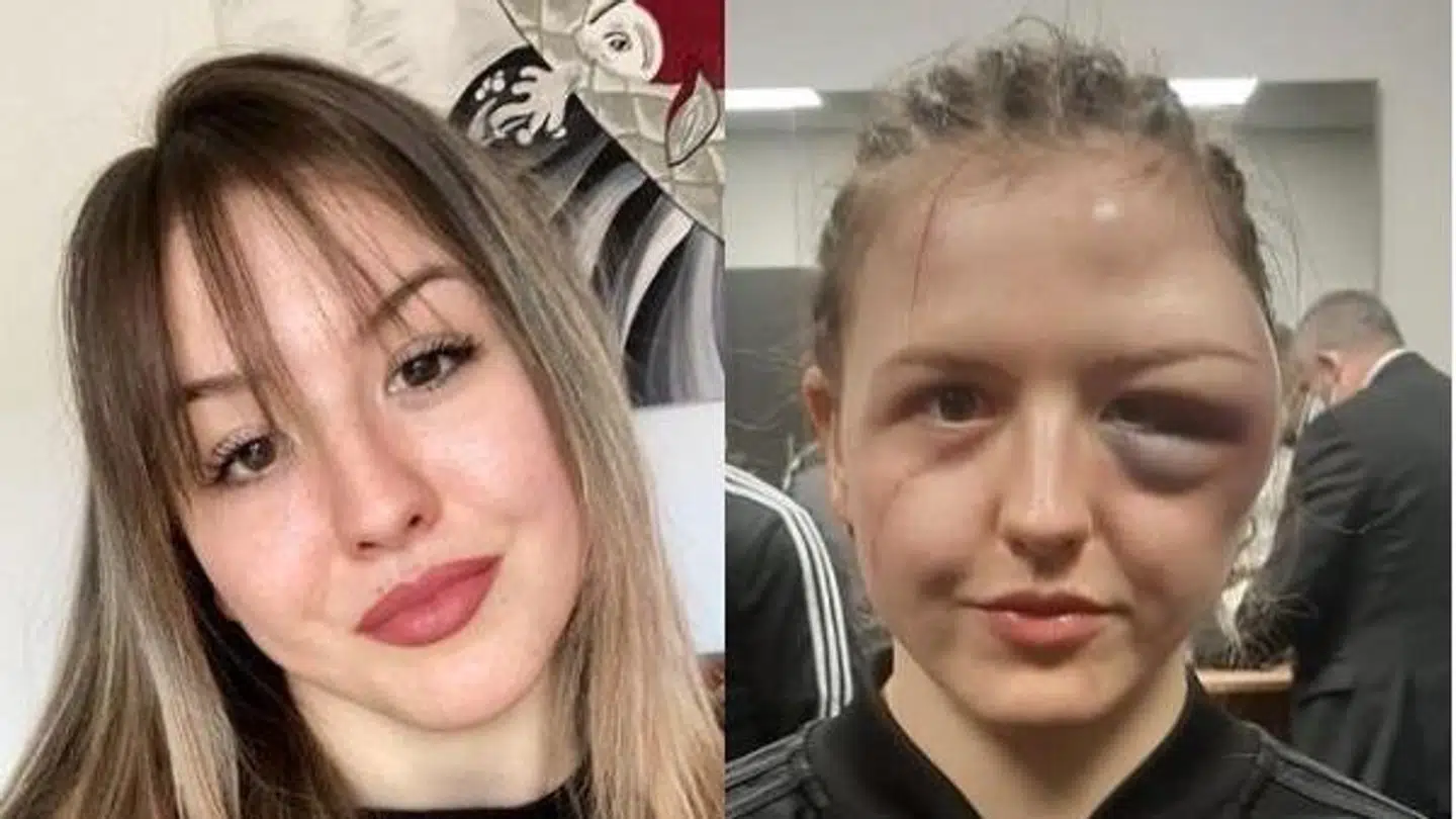 Foto: Instagram/Cheyenne_hanson_boxing