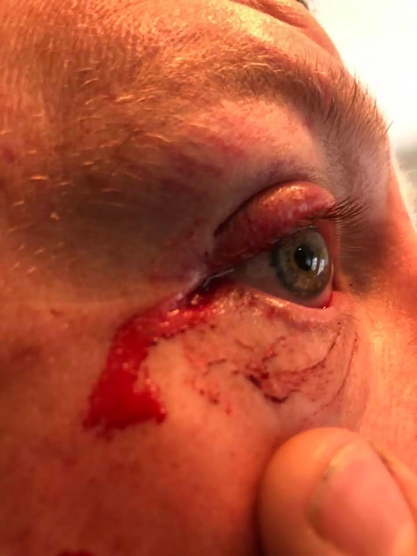 »Uanset om der er nogen, der har gjort det bevidst eller ubevidst, så skal det bare stoppes, for det kan koste folk livet,« siger Henrik Kring efter at være kørt ind i den udspændte nylonsnor på sin mountainbike.