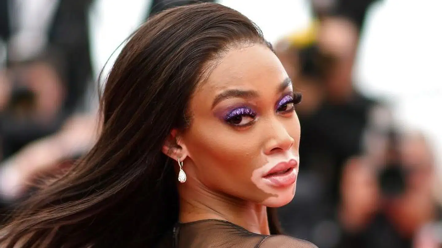 Winnie Harlow havde gjort lidt ekstra ud af lykønskningen til Kyle Kuzma.