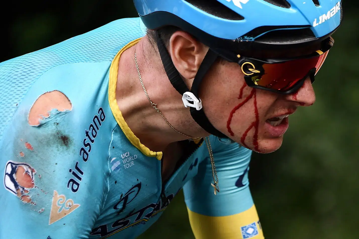 Blodet løb ned af Jakob Fuglsang under de sidste kilometer af årets første Tour de France-etape.