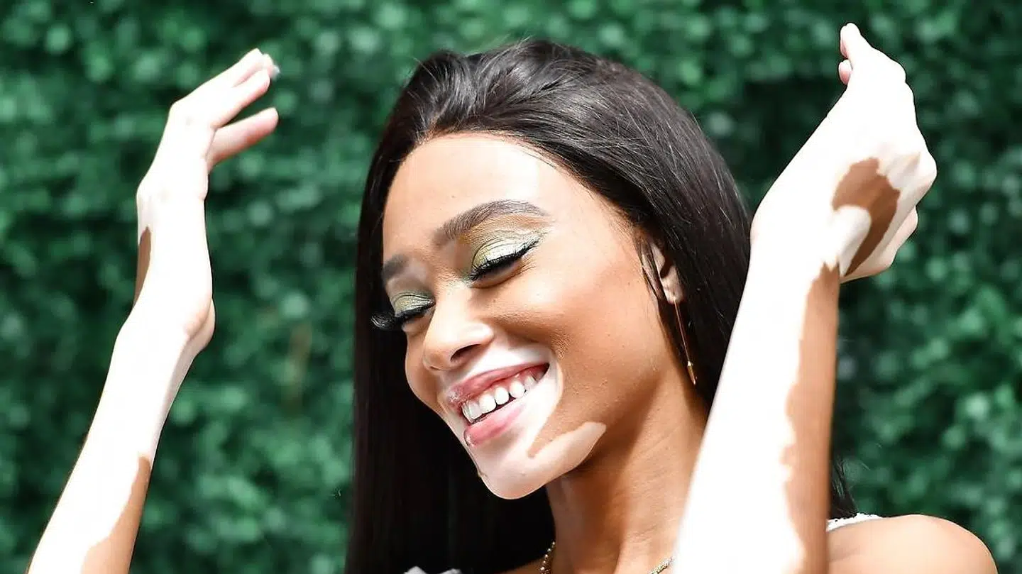 Winnie Harlow fik en uheldig hovedrolle i forbindelse med Canadas Grand Prix.