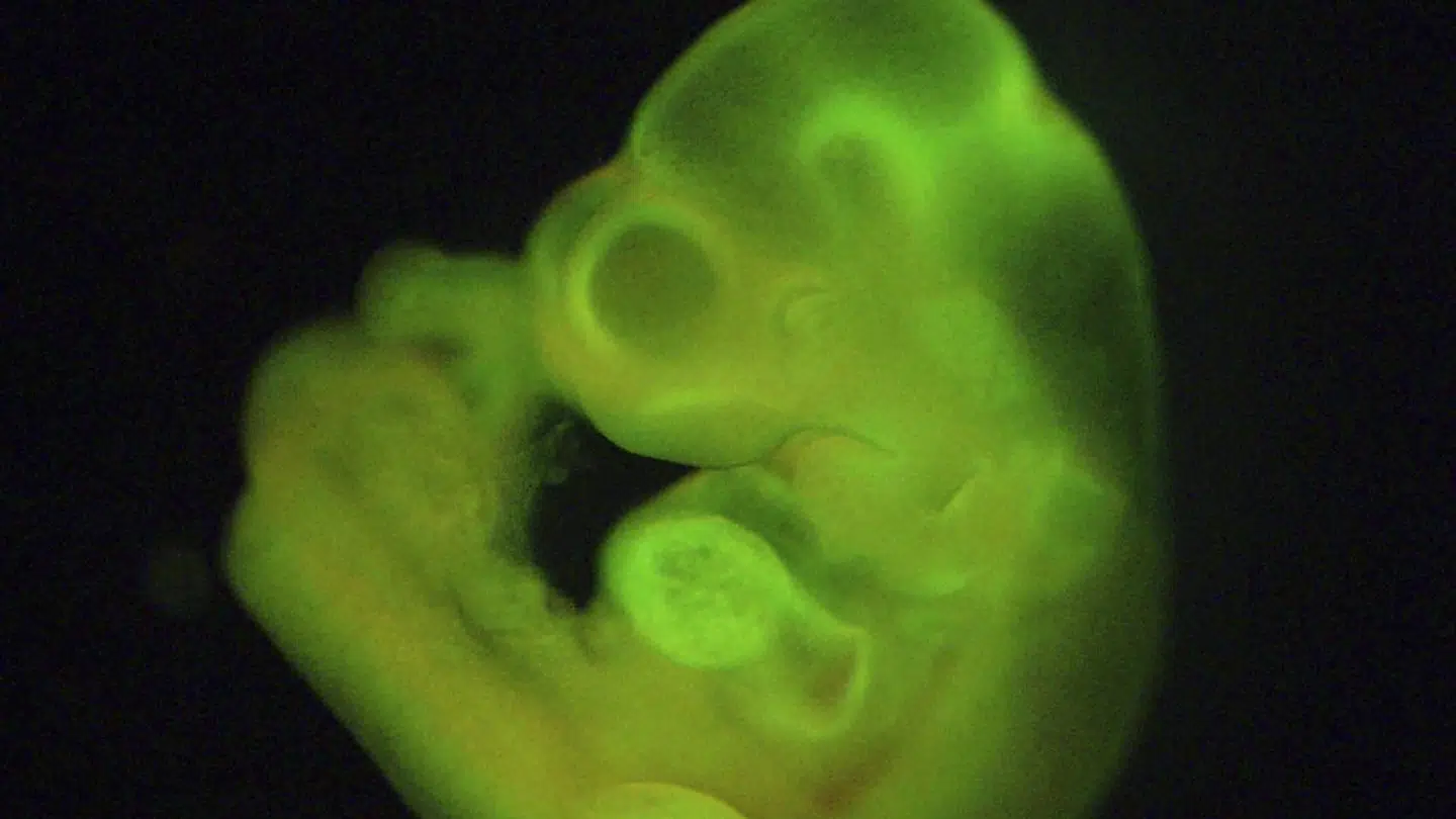 Måske skal fremtidens menneskelige organer til organtransplantation vokse i grise. Det er nu tilladt i Japan at transplantere hybrider af menneskeceller og muse- og rottefostre til andre dyr, hvor organerne muligvis kan vokse sig store. Arkivfoto af et musefoster.