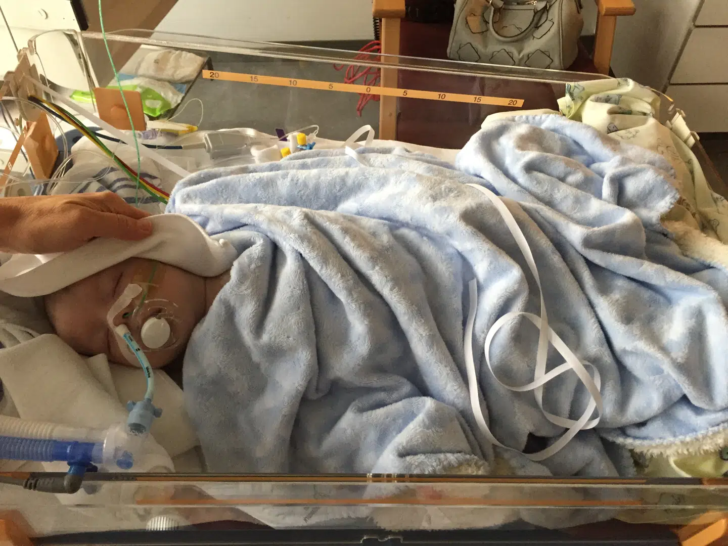 En syv uger gammel Emilio på hospitalet.