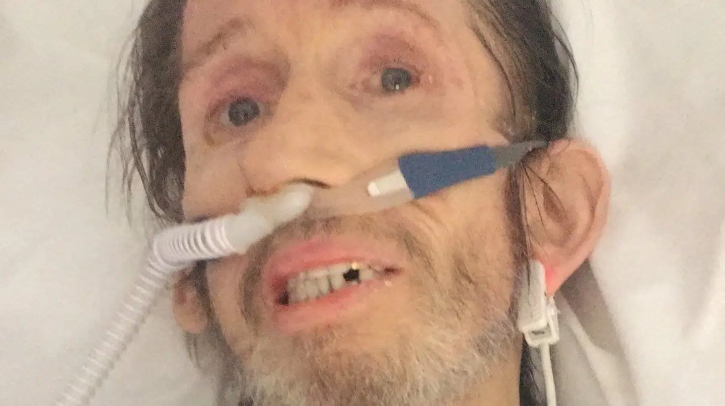 Her ses det seneste billede af den berømte sanger Shane MacGowan.