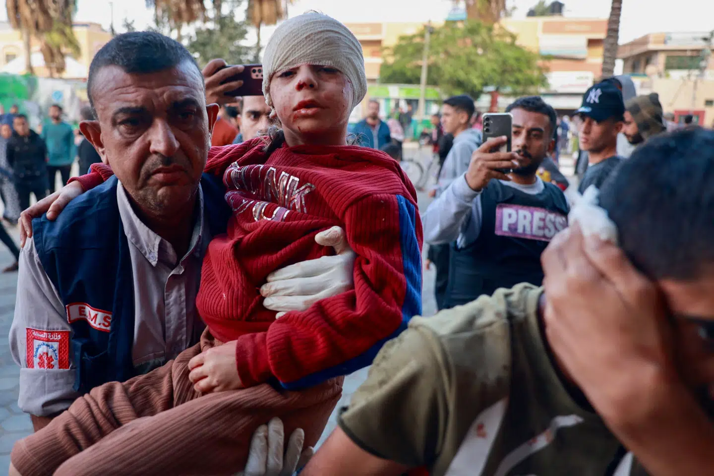 Et såret palæstinensisk barn føres til Al-Aqsa Martyrernes hospital i det centrale Gaza søndag. FN's Generalsekretær, António Guterres, siger, at de civile ofre i konflikten mellem Hamas og Israel er "uacceptable"
