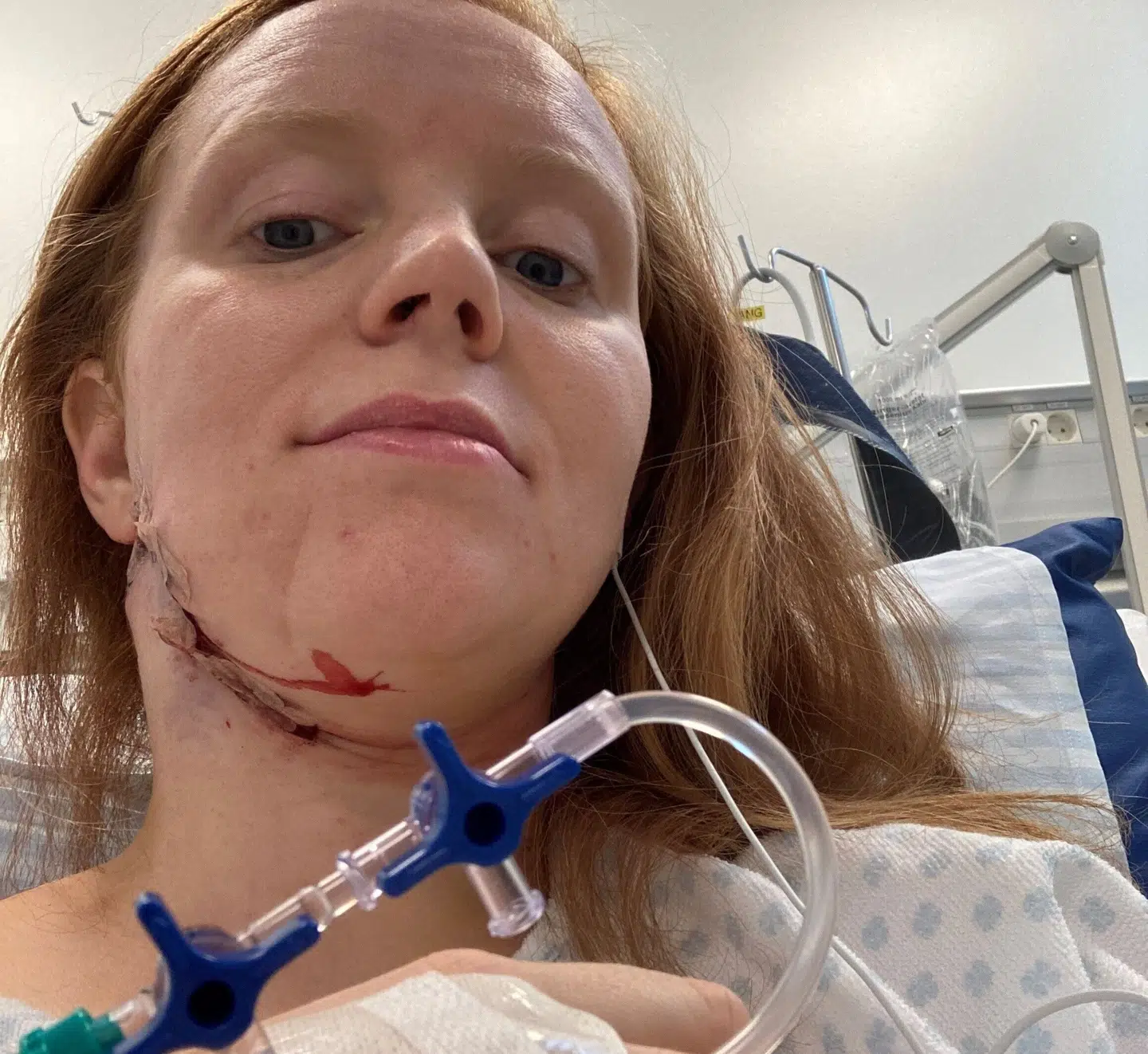 Dina Rosager fik bortopereret et modermærke i ansigtet, men det viste sig efterfølgende, at hun havde modermærkekræft.