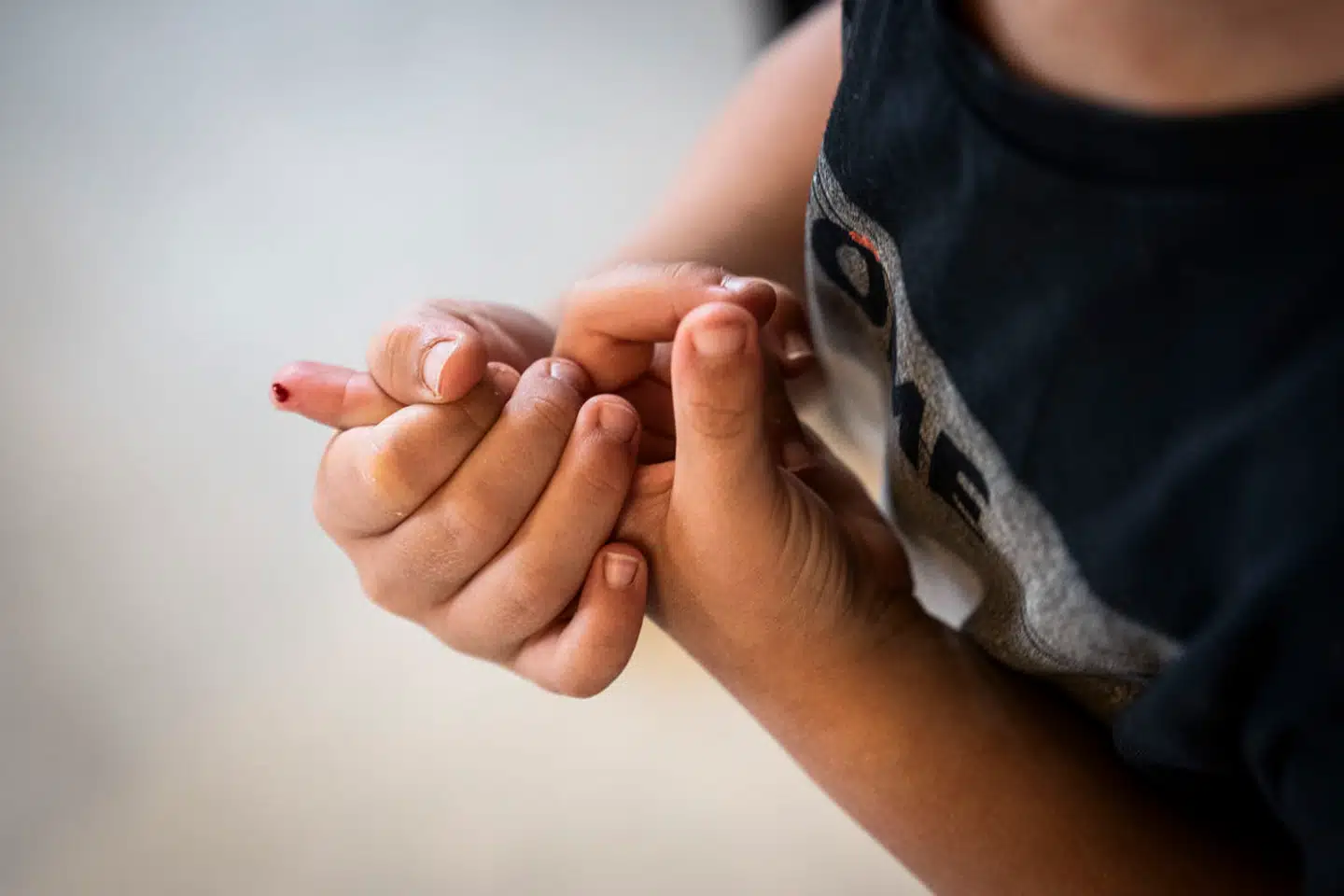 Psykologiske processer påvirker sårheling mere, end vi hidtil har antaget. Arkivfoto: Thomas Traasdahl, Scanpix