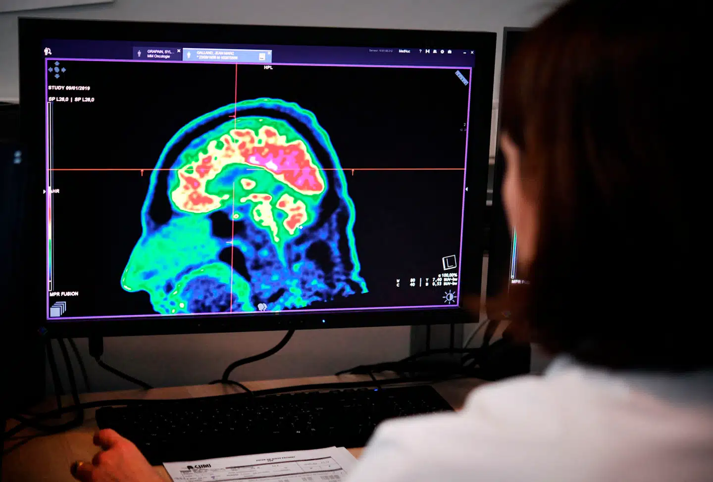 Et nyt studie kortlægger, hvilke faktorer der øger risikoen for tidlig demens. Heldigvis kan vi selv påvirke mange af dem. Arkivfoto: Fred Tanneau/AFP/Ritzau Scanpix