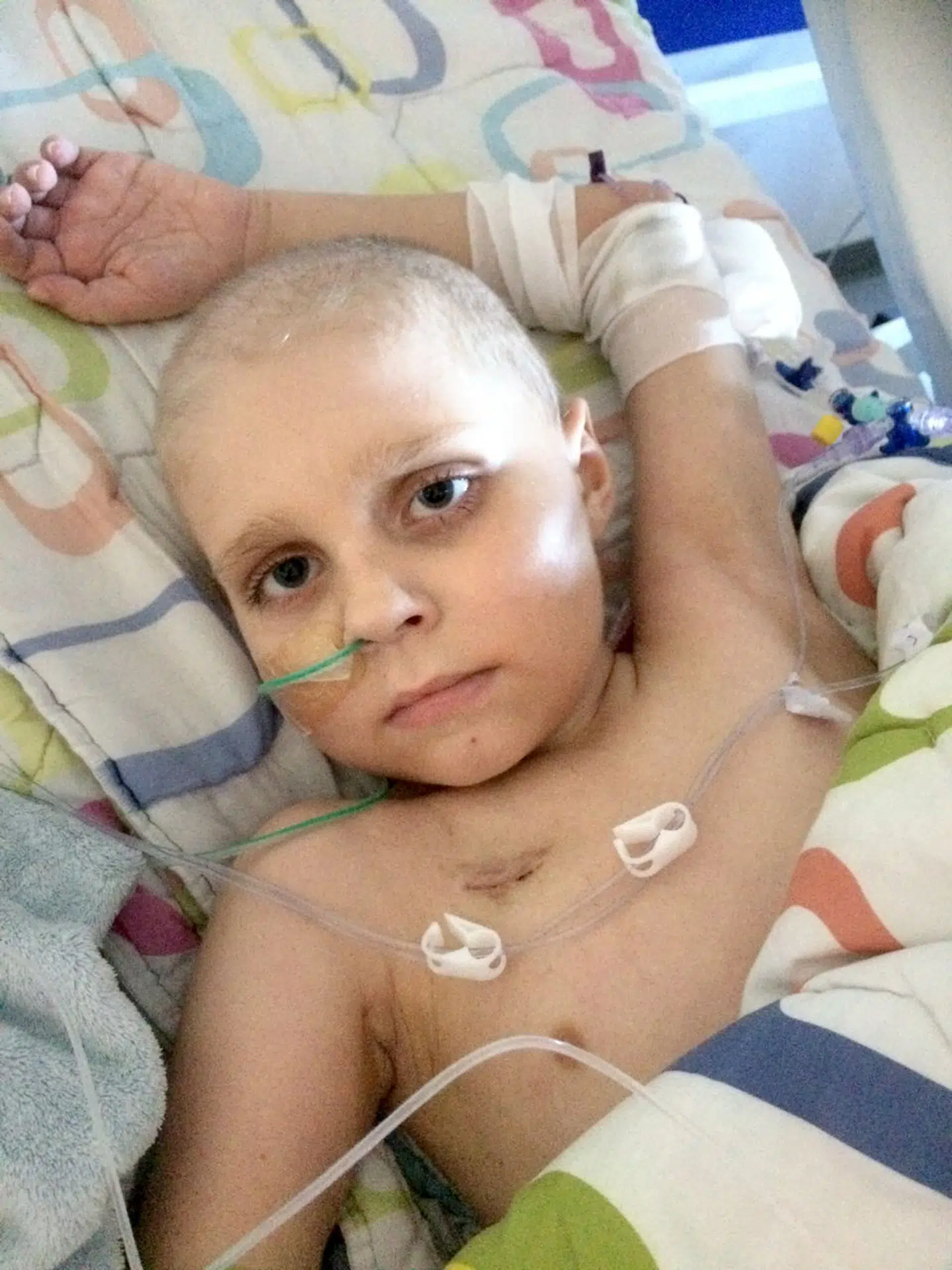 Julius Kargaard Bytov kunne intet og måtte flere dage i respirator, da han blev ramt af en livsfarlig infektion med skimmelsvamp. Hans mor fortæller, at hun på det tidspunkt frygtede, at han ville dø.