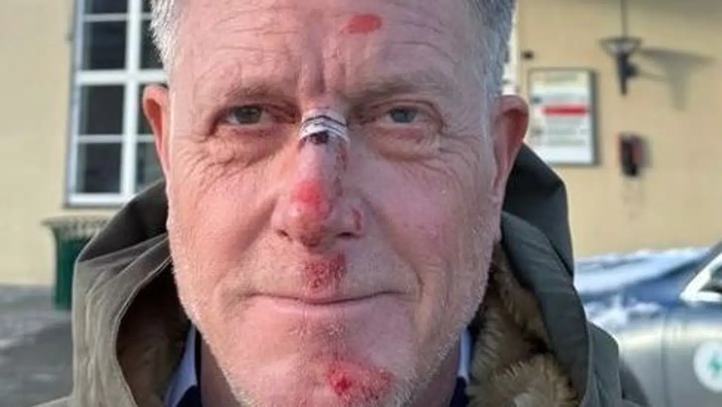 Sådan så Peter Mygind ud efter sit fald.