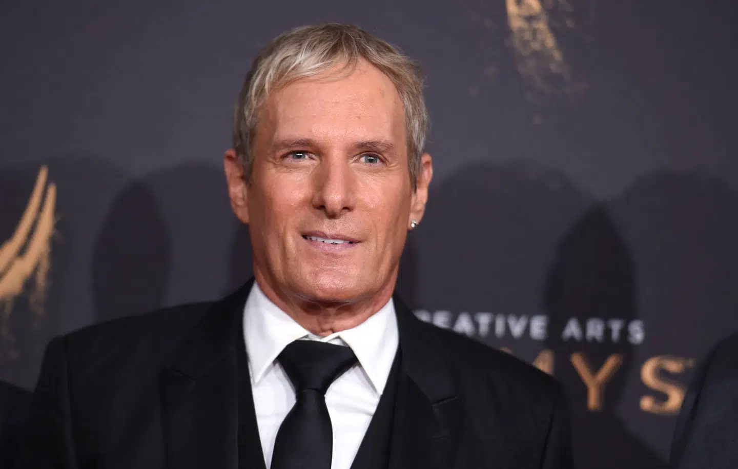 Michael Bolton skriver på Facebook, at han for nylig er blevet opereret, fordi han fik konstateret en hjernesvulst.
